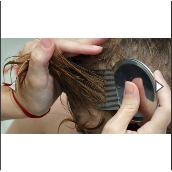 Nitty Gritty Αντιφθειρικό Χτενάκι Nitfree - η μοναδική χτένα για τις ψείρες.. NG800/Green